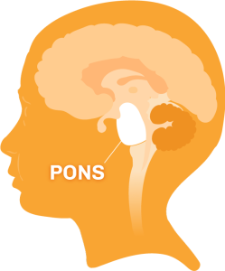 A diagram of the brain and the area impacted by DIPG (dipg,org)